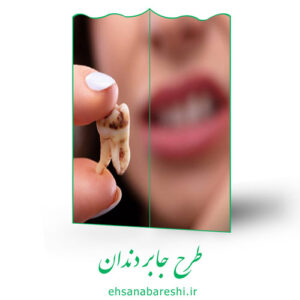 طرح جابر دندان