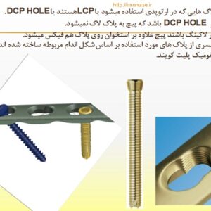 آشنائی با انواع پیچ و پلاک ارتوپدی