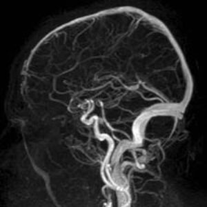 Brain-MRV