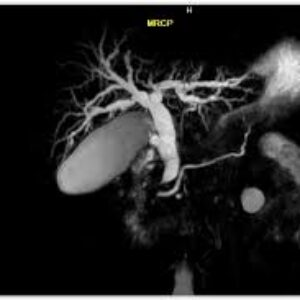 MRCP