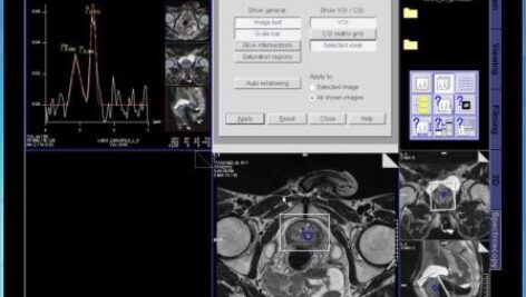 MRS of the  Prostate – step by step