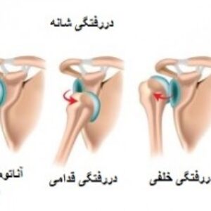 پاورپوینت کامل و جامع با عنوان آشنایی با  دررفتگی و انواع آن در تربیت بدنی در 42 اسلاید