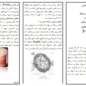 پمفلت سرخک