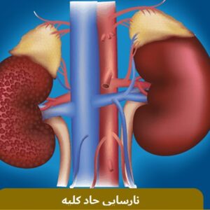 دانلود مقاله در مورد نارسایی کلیه (پاورپوینت )