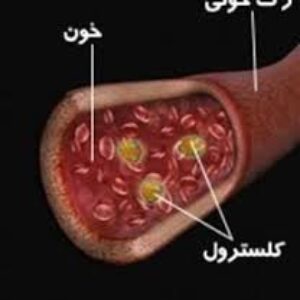 گزارش کار آزمایشگاه با عنوان آزمایش لیبرمن – بوشارد (تشخیص کلسترول)