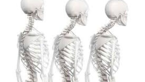 دانلود جزوه ی حرکات اصلاحی(تعادل)دکتر مینونژاد از مباحث رشته ی تربیت بدنی pdf