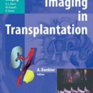 Imaging in Transplantation