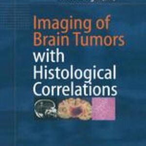 Imaging of Brain Tumors with Histological Correlations